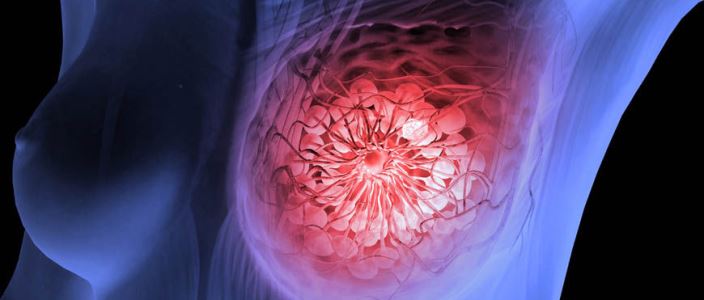 Cele mai importante interventii chirurgicale efectuate in Spitalul OncoFort, AUGUST 2014